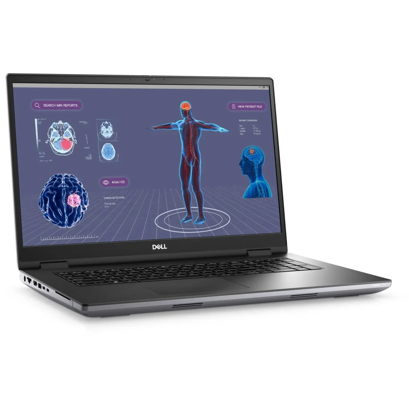 Ноутбук Dell Precision 7780 (N003P7780ADA4516WP)