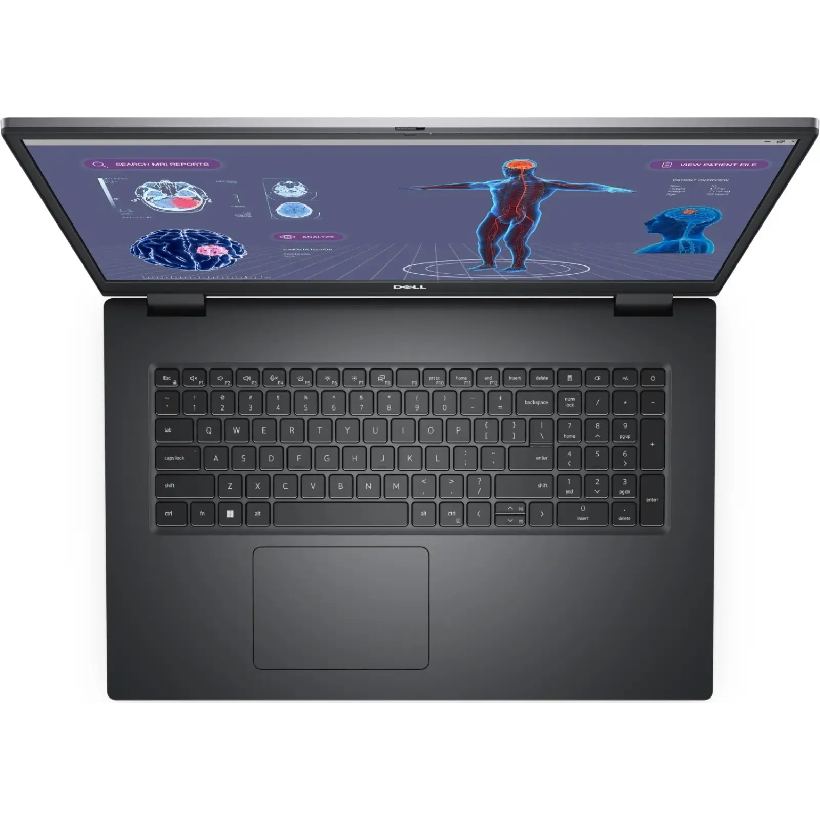 Ноутбук Dell Precision 7780 (N003P7780ADA4516WP)