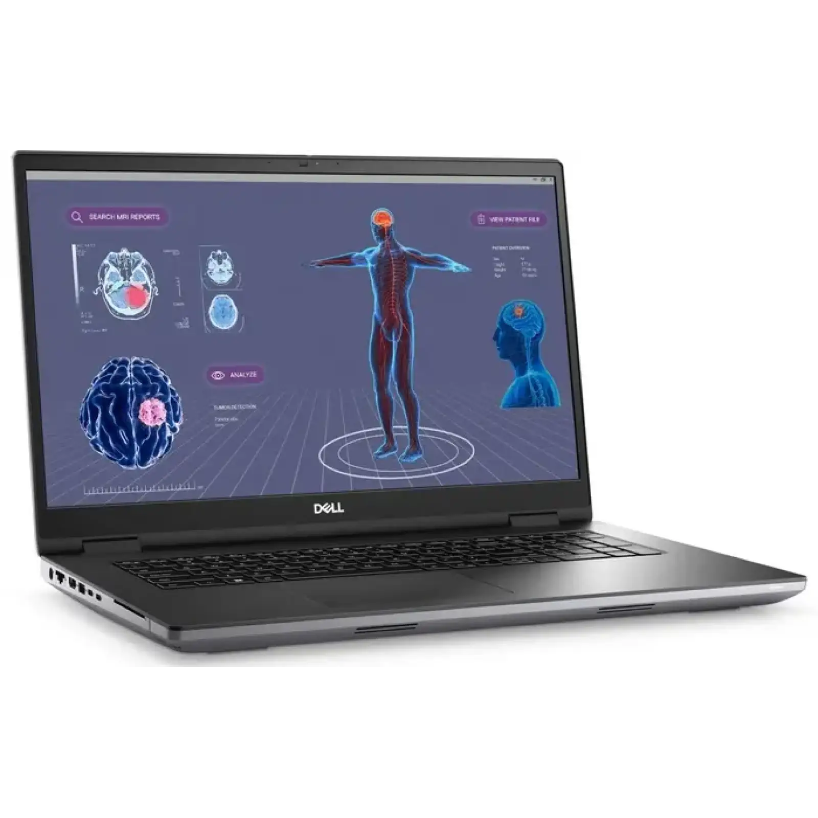 Ноутбук Dell Precision 7780 (99SCR74)