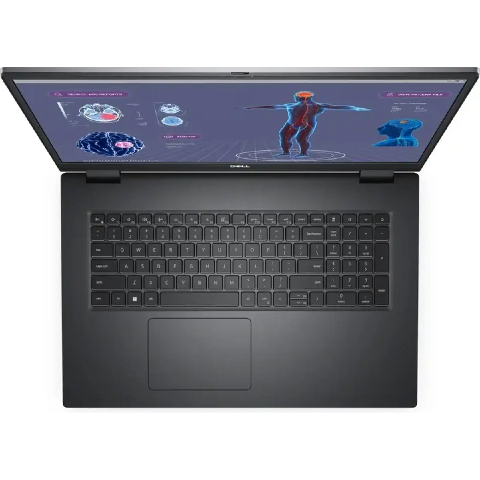 Ноутбук Dell Precision 7780 (99SCR74)