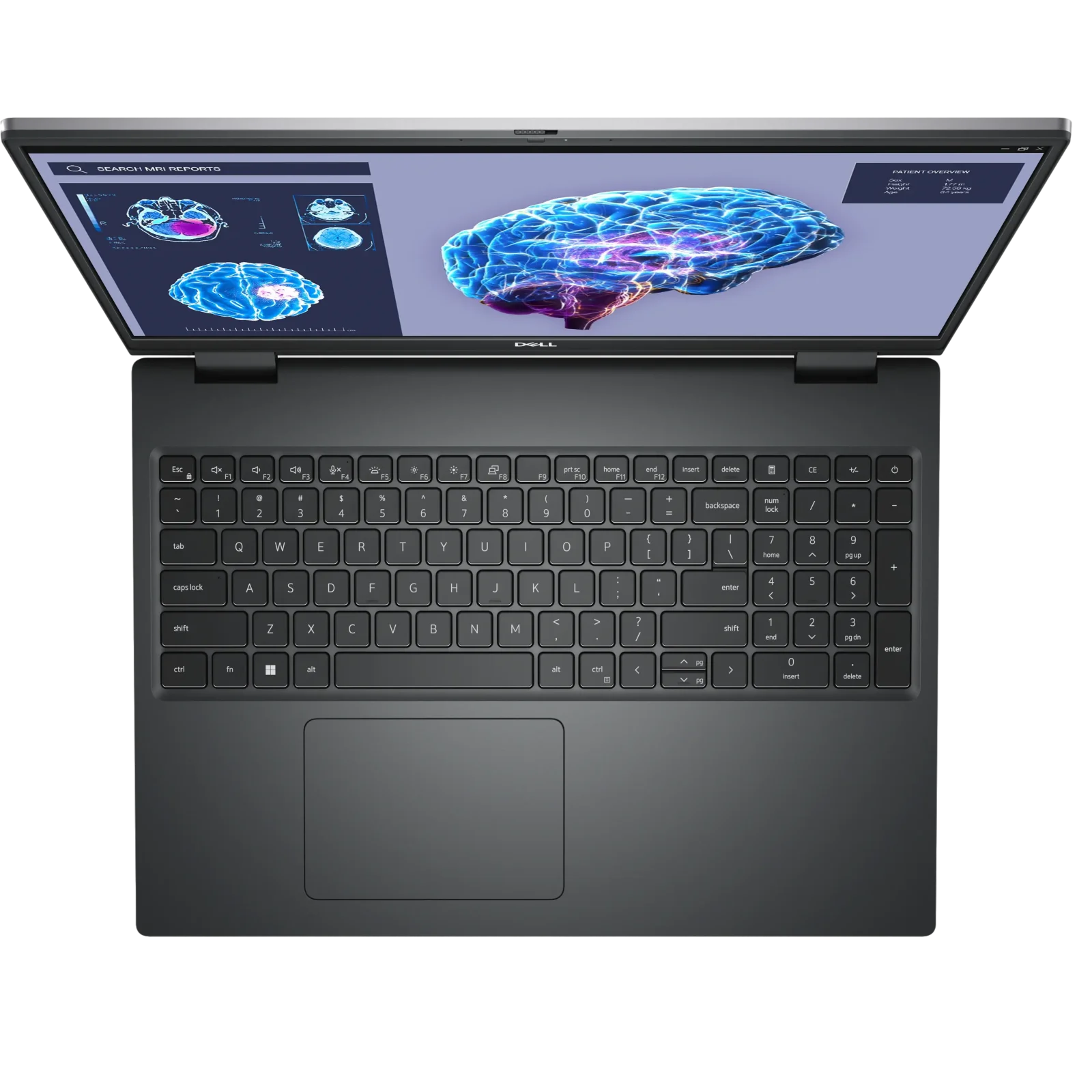 Ноутбук Dell Precision 7780 (N003P7780ADA3521WP)