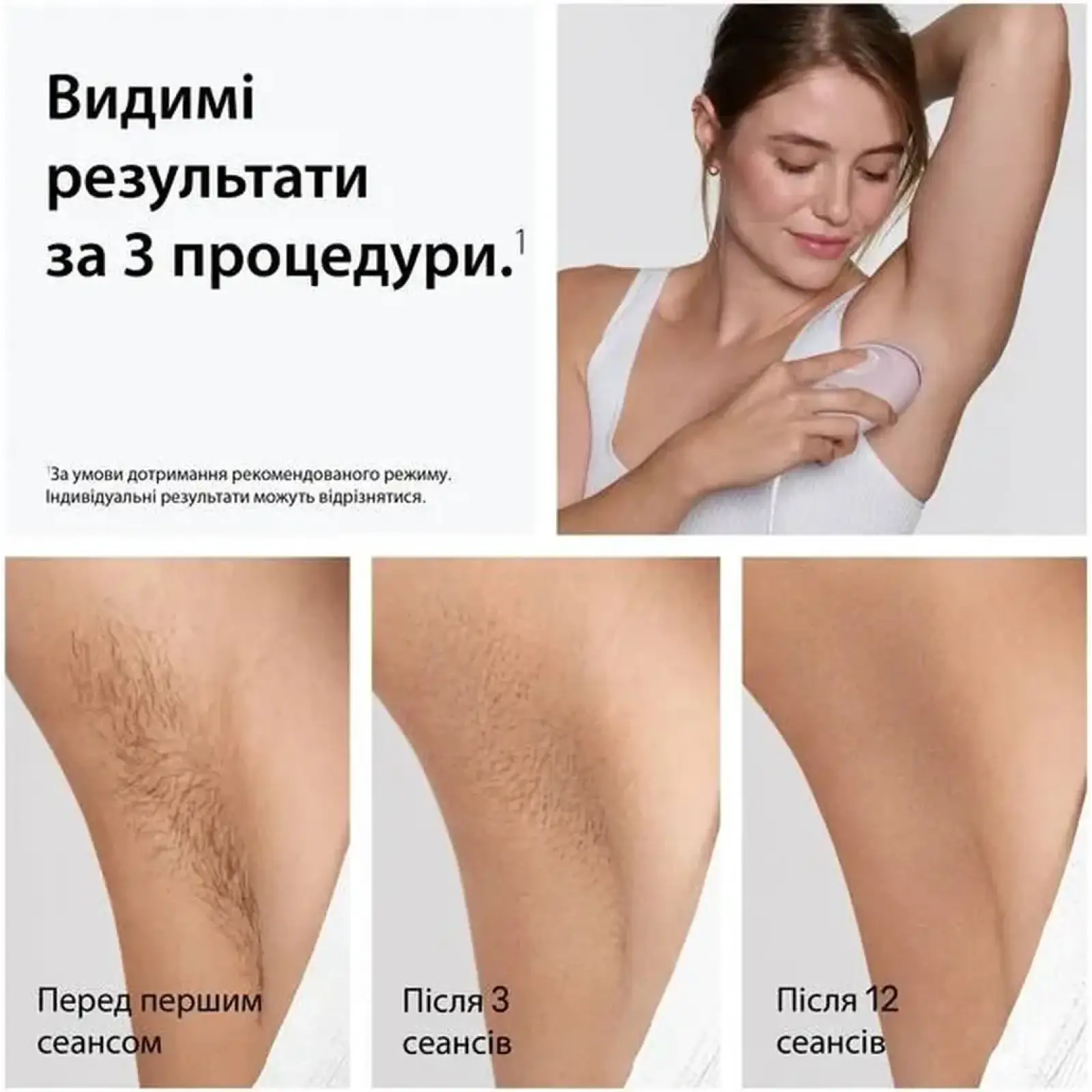 Фотоэпилятор Braun Silk-expert Mini IPL PL1111 + GIL Venus UA