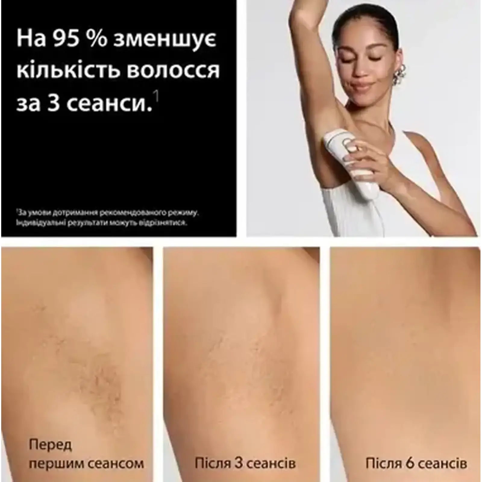 Фотоэпилятор Braun Silk-Expert Pro 5 PL5351 + GIL Venus UA