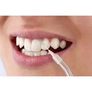 Ирригатор Sencor SOI 1311GD UA