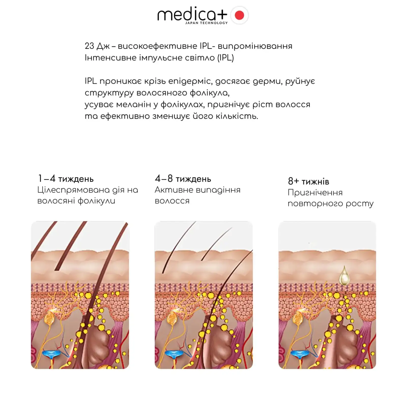 Фотоепілятор охолоджуючий MEDICA+ ICE PRO 10X UA