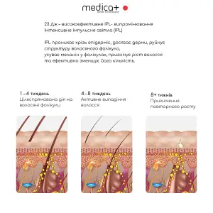 Фотоепілятор охолоджуючий MEDICA+ ICE PRO 10X UA