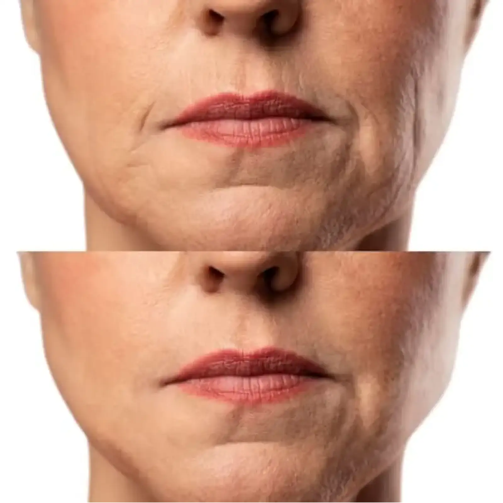 Мікрострумовий RF Lifting Масажер для обличчя Skin Lifting 7.0 White - EMS, LED Medica+ UA