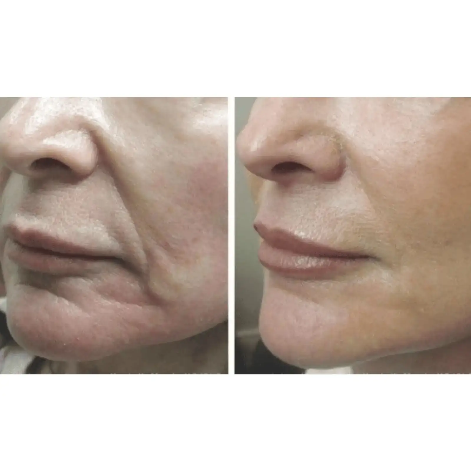 Мікрострумовий ліфтинг-масажер MEDICA+ Skin Lifting 5.0 UA