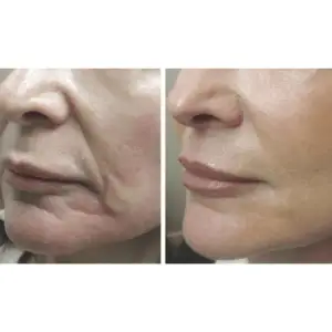 Мікрострумовий ліфтинг-масажер MEDICA+ Skin Lifting 5.0 UA