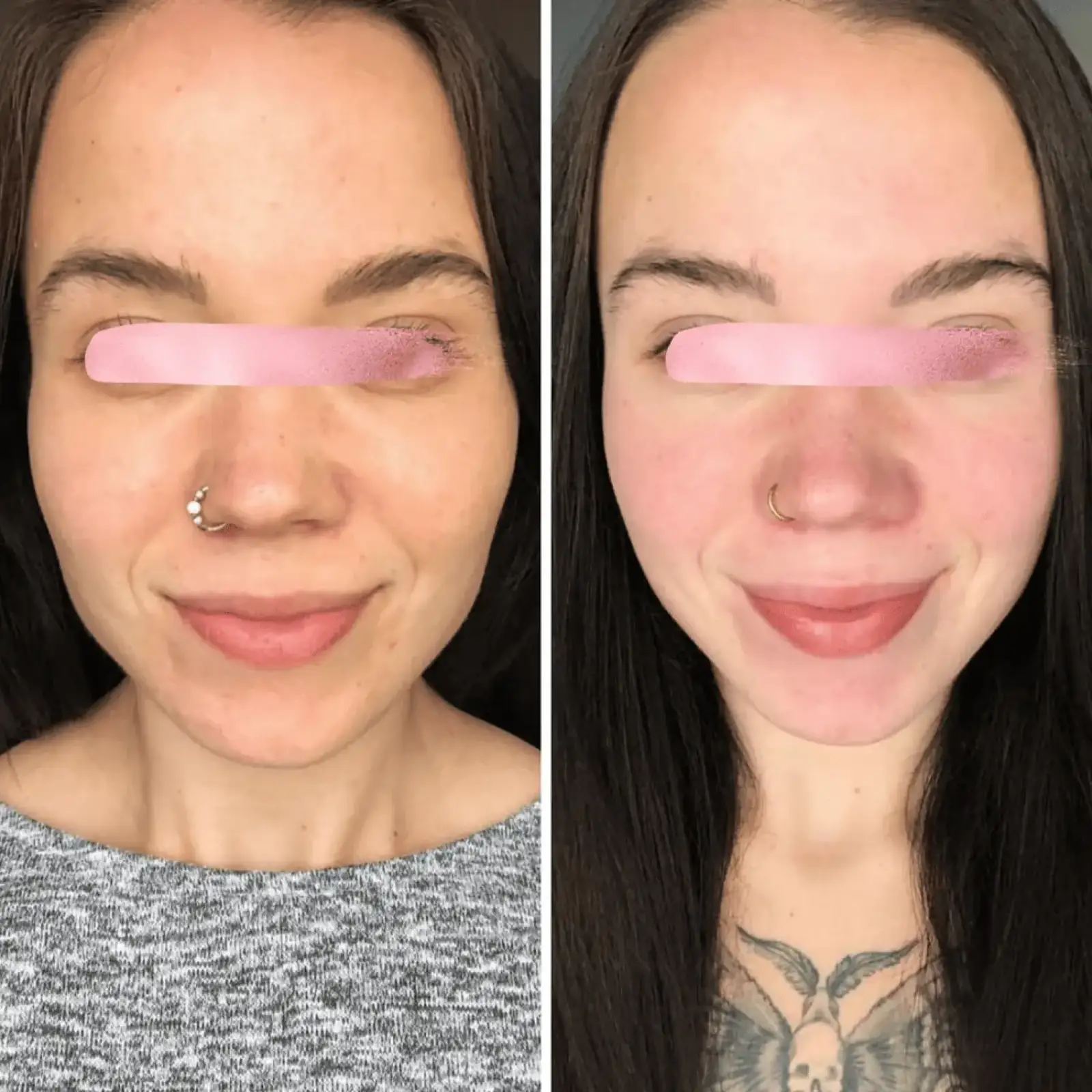 Мікрострумовий ліфтинг MEDICA+ Skin Lifting 6.0 pink UA
