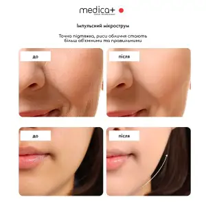 Масажер для обличчя MEDICA+ SkinLifting PRO 10x з мікрострумом, RF та функцією ліфтингу UA