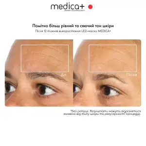 LED-маска для світлотерапії MEDICA+ LEDMask 8X UA