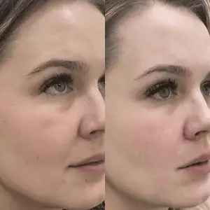Гідратуючий гель MEDICA+ Hydration Gel (100 мл) UA