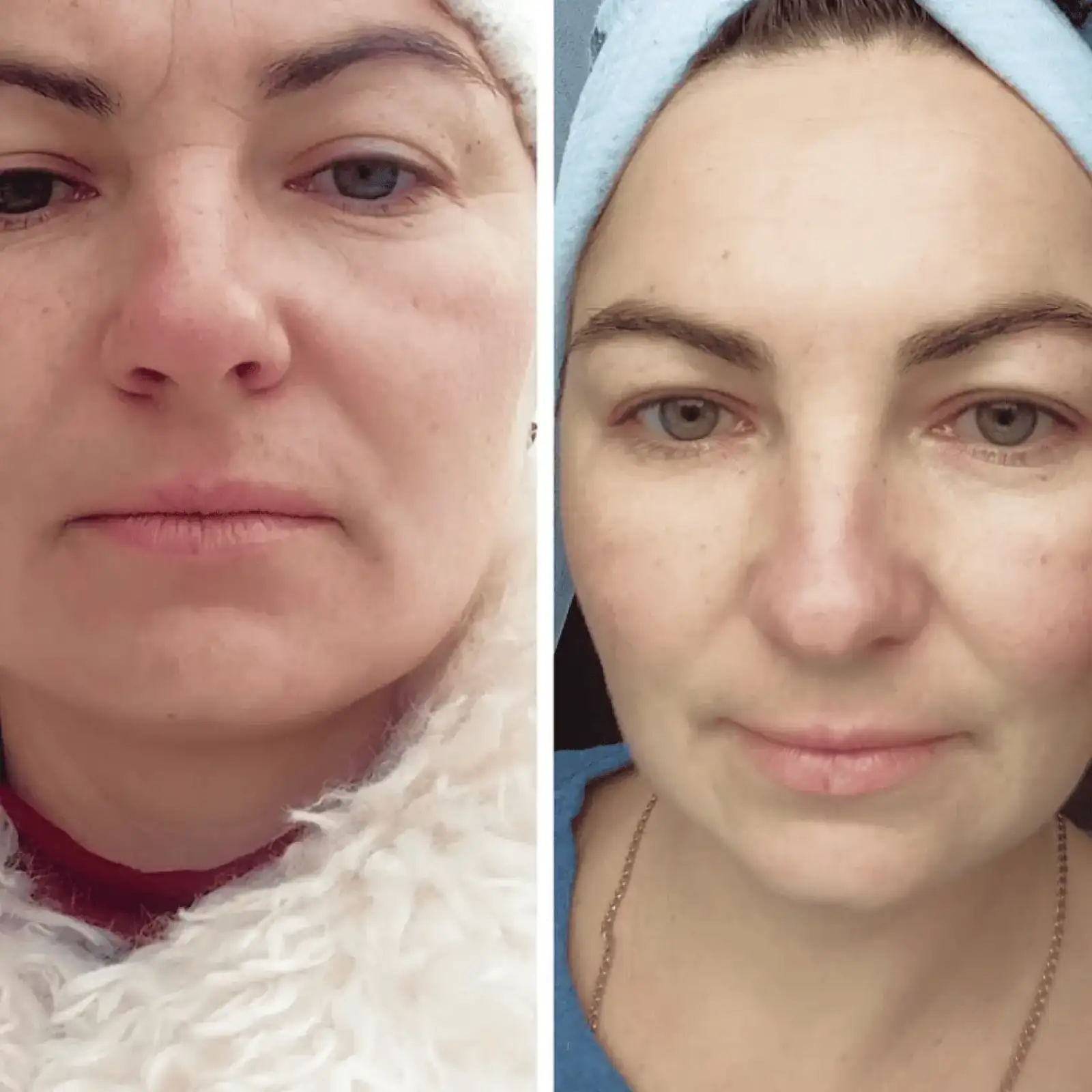 Заспокійлива маска для обличчя MEDICA+ Soothing Mask (50 мл) UA