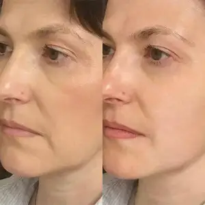 Порозвужувальна маска для обличчя MEDICA+ Pore Control Mask (50 мл) UA
