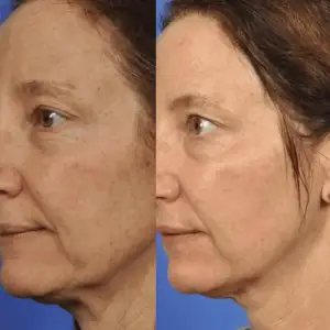 Струмопровідний гель MEDICA+ Conductive Lifting Gel (100 мл) UA
