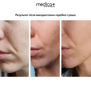 Сталевий скребок гуаша для моделювання овалу обличчя MEDICA+ Steel GuaSha UA