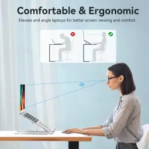 Підставка для ноутбука Laptop X-type Stand Silver Aluminum Alloy Vention (KDMI0) UA