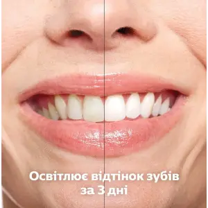 Набір із 2-х електричних зубних щіток Philips Sonicare DiamondClean 9000 White & Black (HX9914/57)
